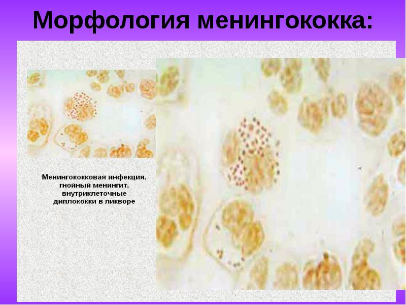 Менингококковая инфекция презентация