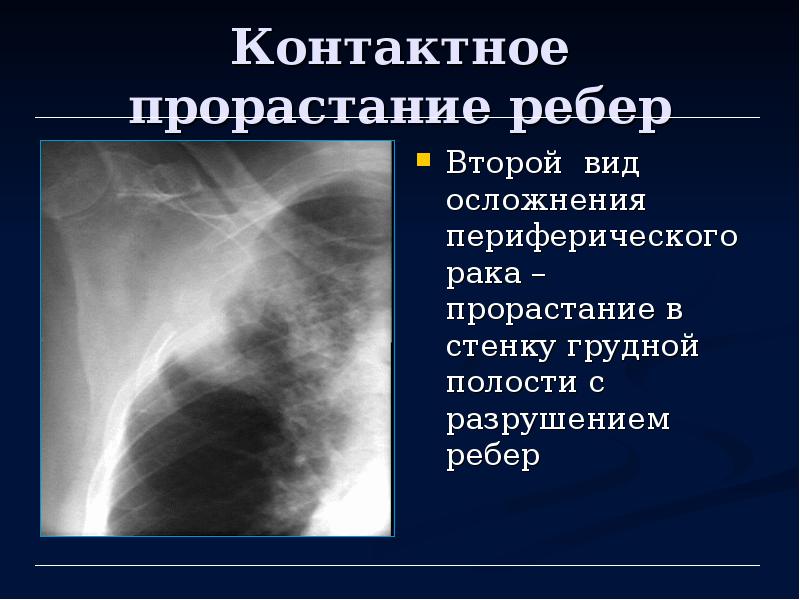 Лучевая диагностика органов дыхания презентация