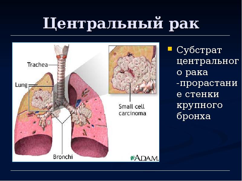 Презентация на тему заболевания органов дыхания