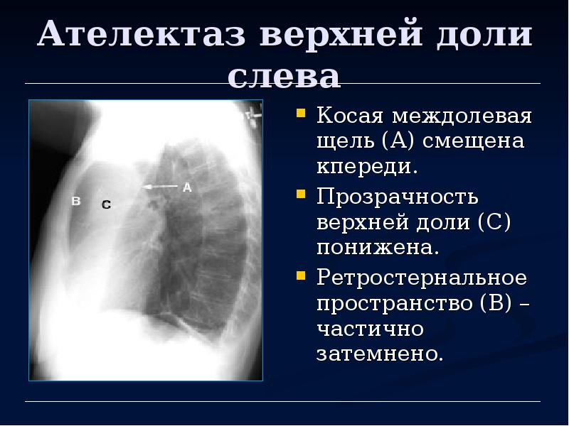 Методы лучевой диагностики органов дыхания презентация