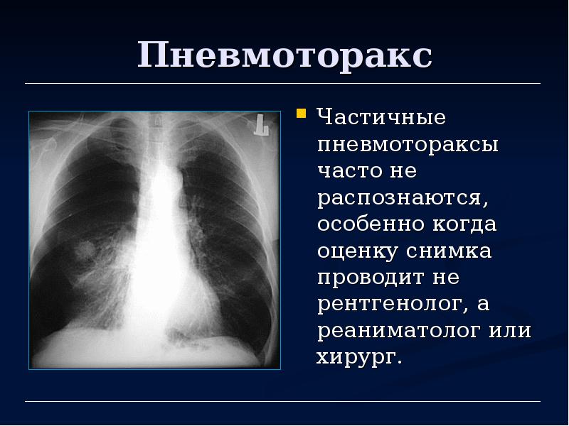 Лучевая диагностика органов дыхания презентация