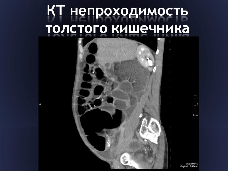 Презентация лучевая диагностика неотложных состояний