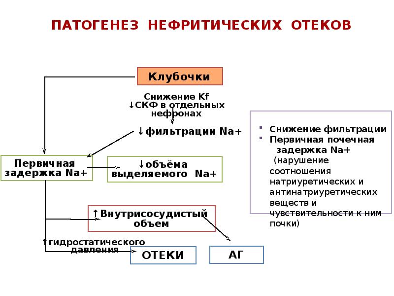 Нефротический синдром патогенез схема