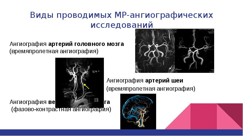 Исследование артерий