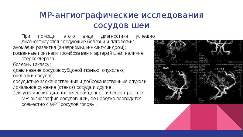 Исследование артерий. Аномалии развития вен шеи. Ангиографическое исследование. Исследование сосудов. Виды ангиографических исследований.