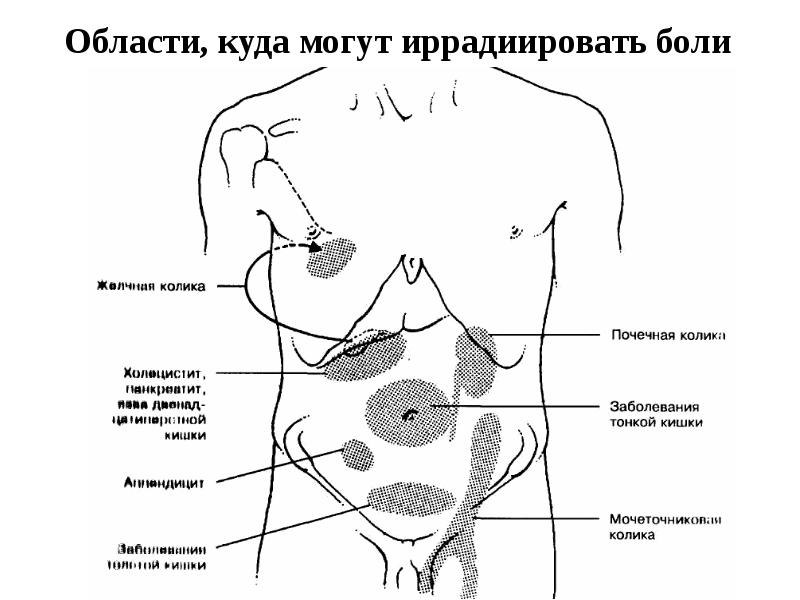 Покажите схему живота где что болит