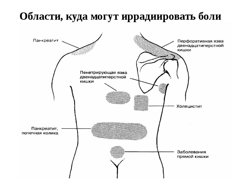 Болит спина. Поджелудочная отдает в спину. Положение больного при остром панкреатите. Поджелудочная отдает в спину. Болит поджелудочная железа.