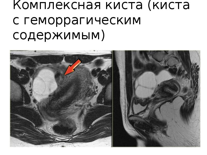 Рисунок женского органа