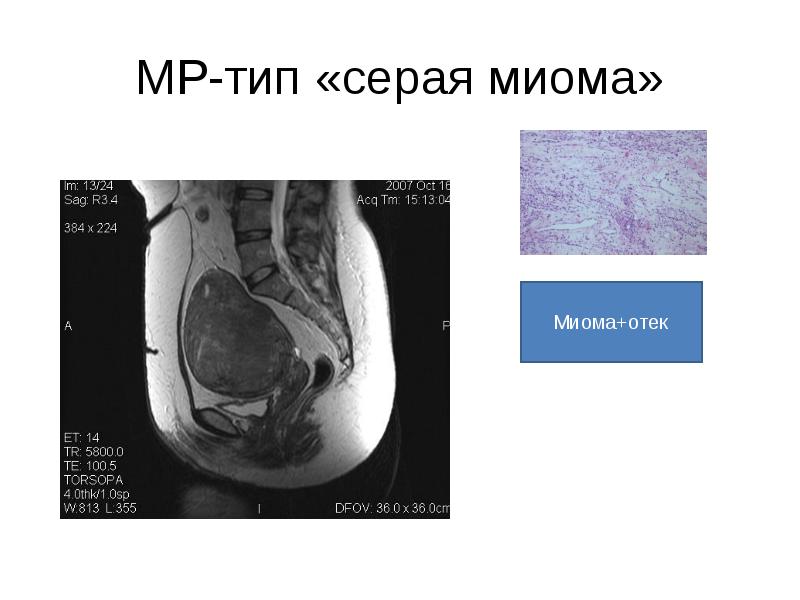 Схема женских органов малого таза