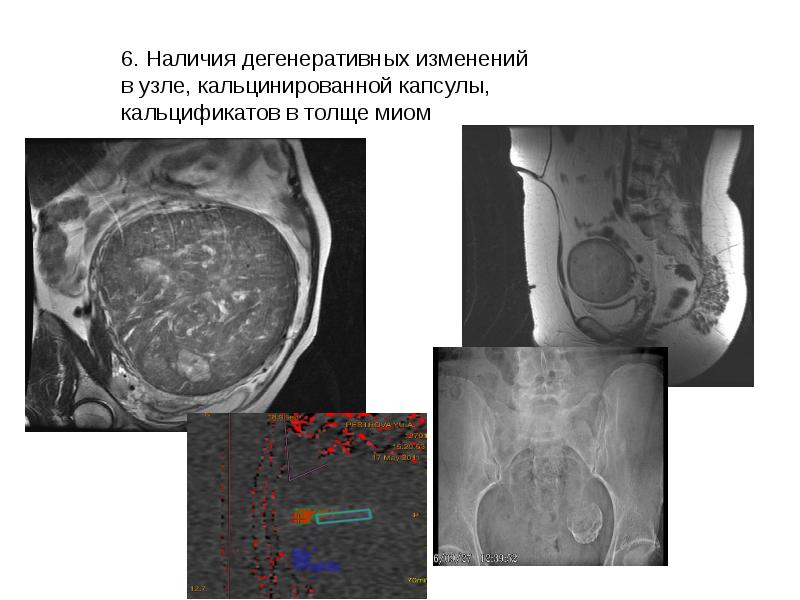 Схема женских органов малого таза