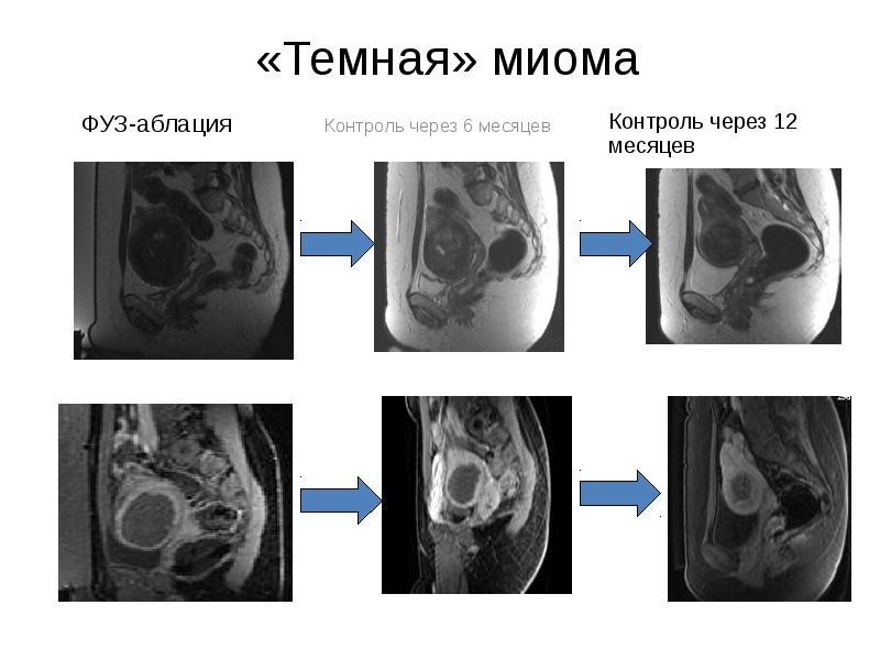 Рисунок женского органа