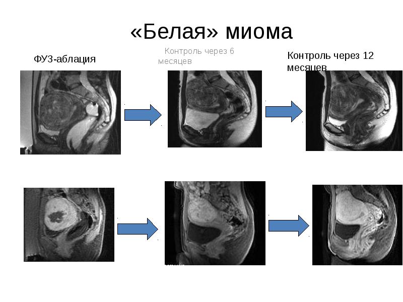 Схема женских органов малого таза