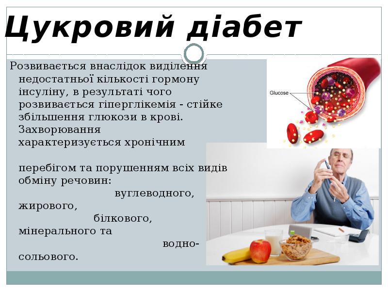 Цукровий діабет   Розвивається внаслідок виділення недостатньої кількості гормону інсуліну,