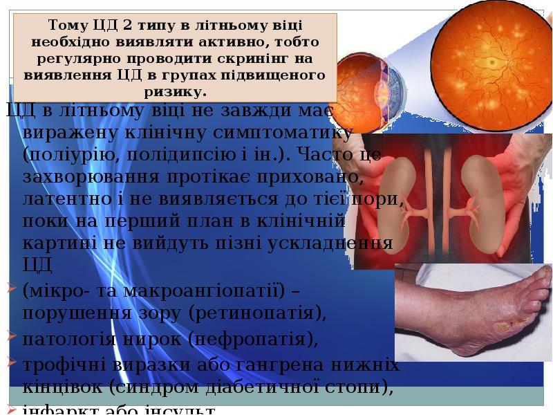 ЦД в літньому віці не завжди має виражену клінічну симптоматику (поліурію,