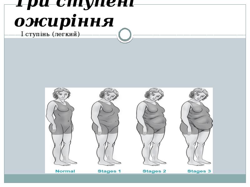 Три ступені ожиріння