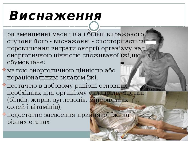 Виснаження При зменшенні маси тіла і більш вираженого ступеня його -