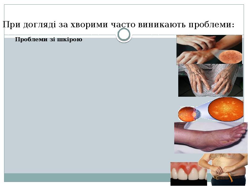 При догляді за хворими часто виникають проблеми: