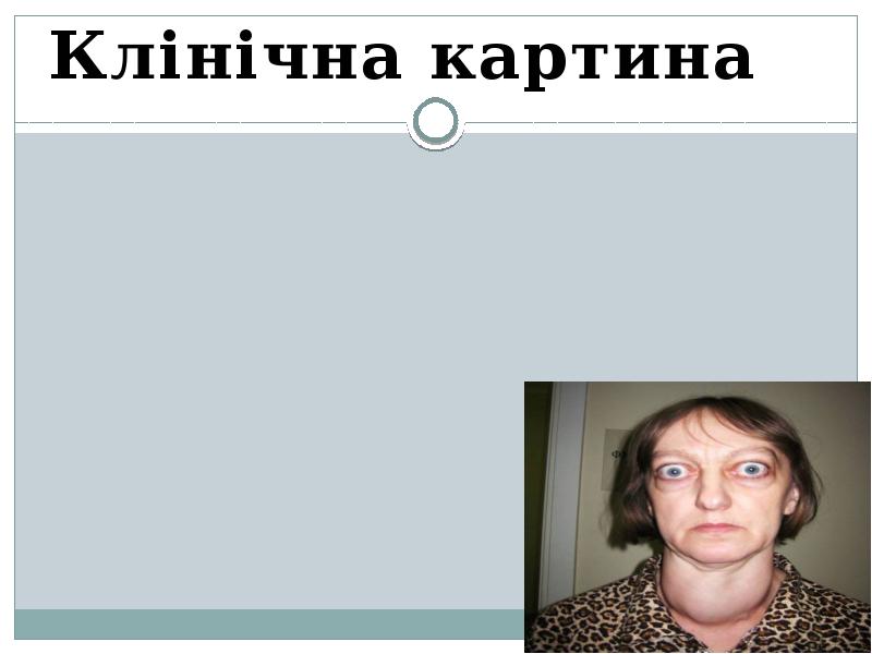 Клінічна картина