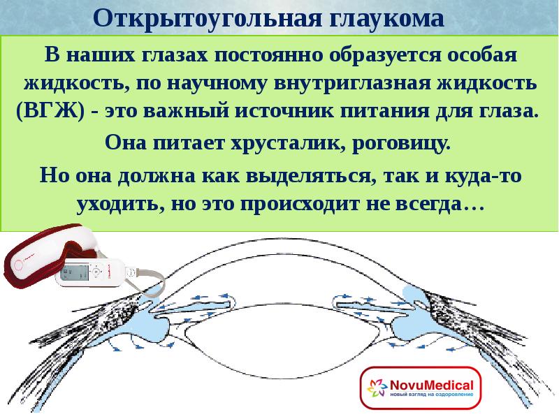 Для открытоугольной глаукомы характерны тест. Открытоугольная глаукома презентация. Внутриглазная жидкость образуется. Внутриглазная жидкость питает. Открытоугольная глаукома опасна течением.