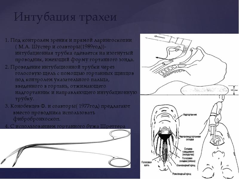 Острый и хронический стеноз гортани презентация