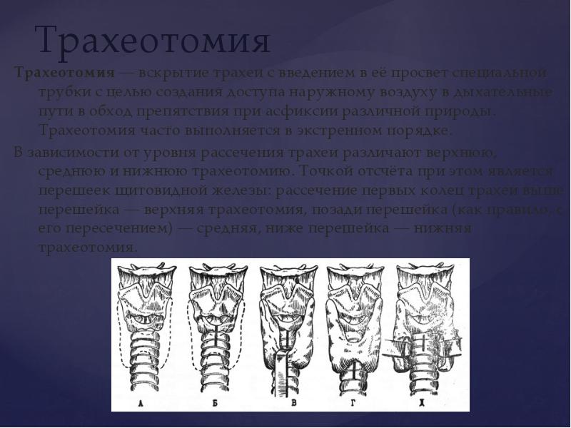 Острый и хронический стеноз гортани презентация