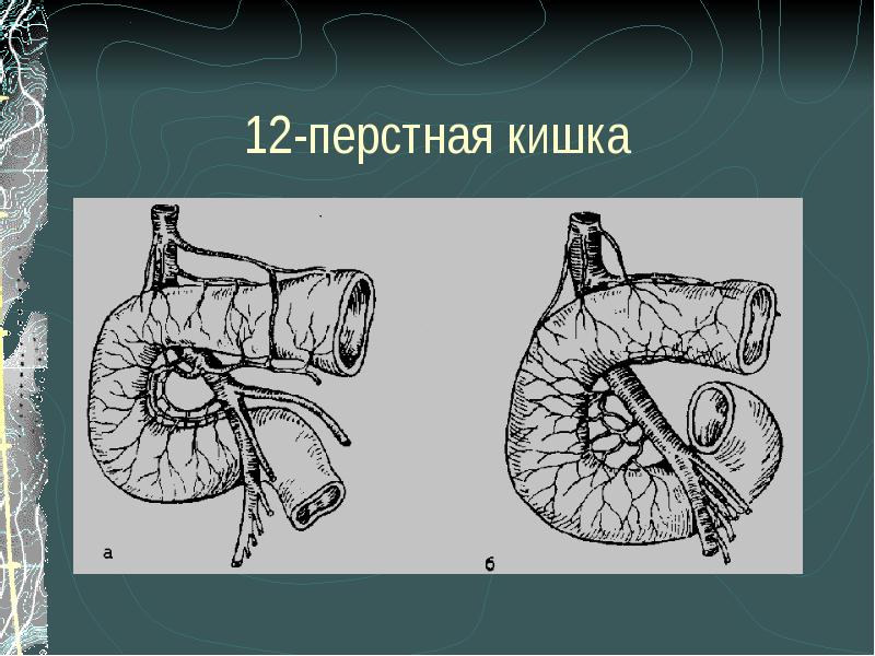 Язва желудка и 12 перстной кишки презентация