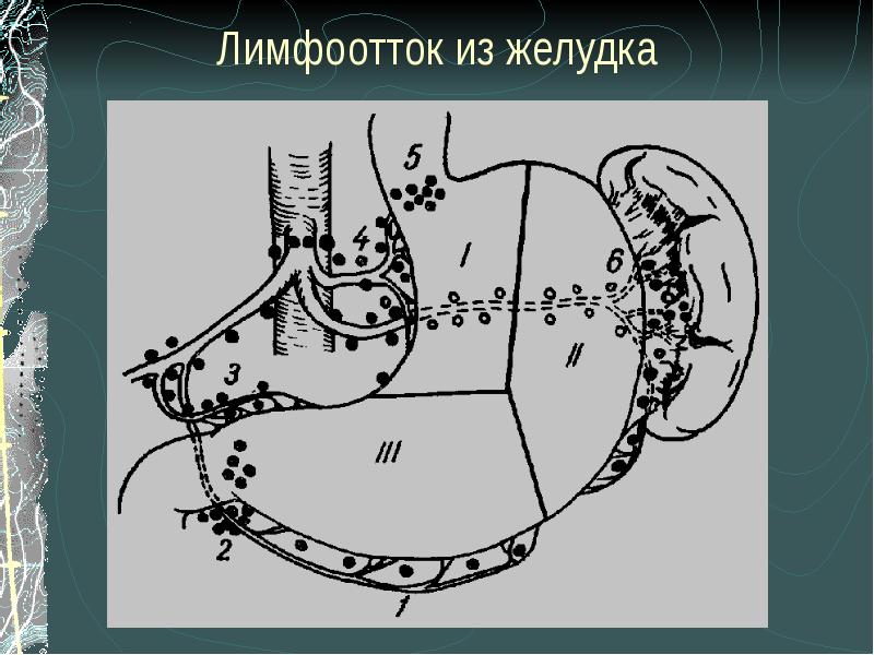 Язва желудка и 12 перстной кишки презентация