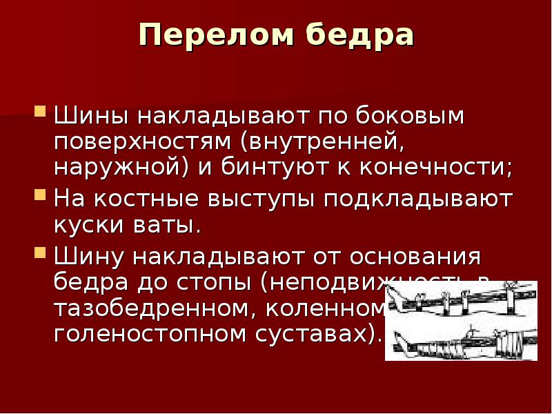 Презентация на тему переломы костей