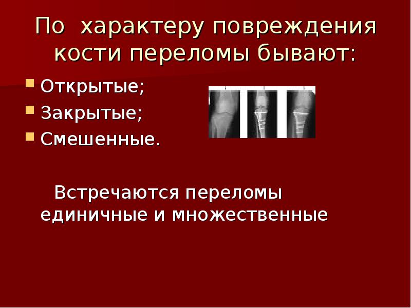 Характер травм. По характеру повреждения кости переломы бывают. Презентация на тему переломы костей. Открытые переломы презентация. Перелом кости для презентации.