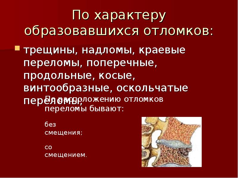 Открытый перелом кости презентация