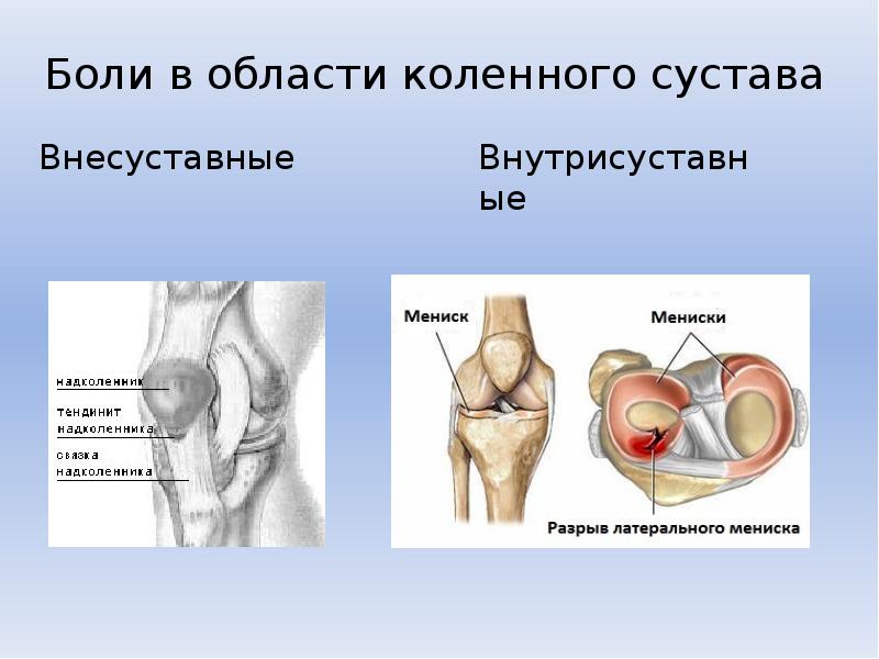 Презентация коленный сустав