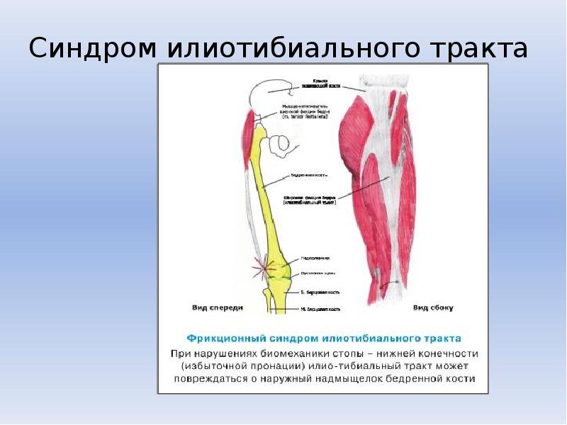 Подвздошно большеберцовый тракт. Синдром подвздошно-большеберцового тракта. Большеберцовый тракт анатомия. Колено бегуна илиотибиального тракта синдром трения. Илиотибиальный синдром коленного сустава.