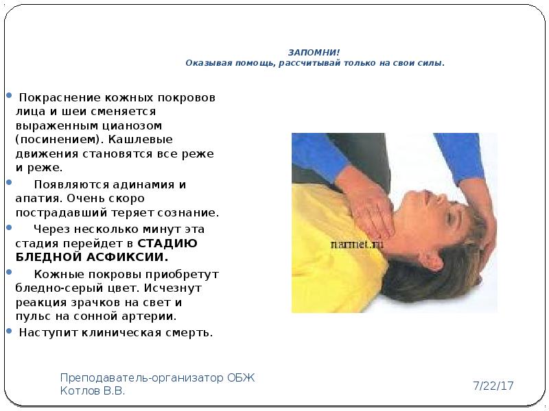 Первая помощь при попадании инородных тел в верхние дыхательные пути презентация