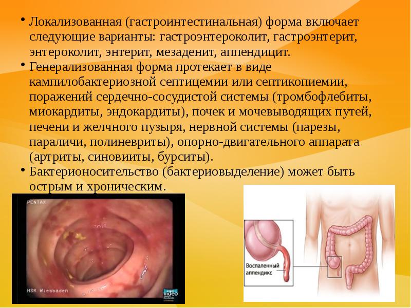 Que se puede comer con gastroenterocolitis