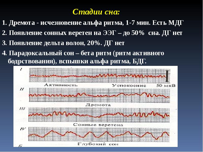 Нарисовать схему стадий сна по данным ээг