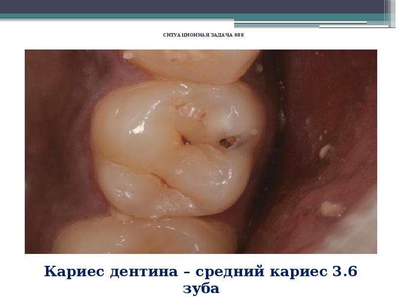 Презентация по стоматологии заболевания