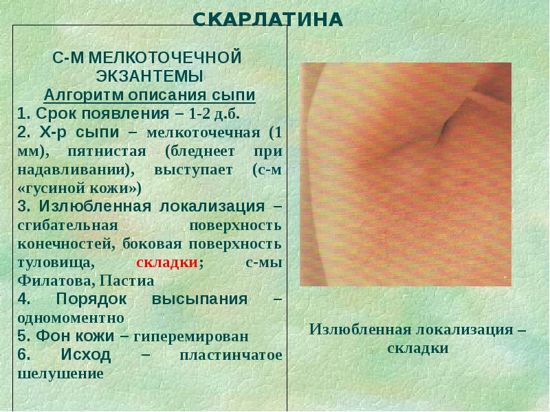 Дифференциальная диагностика сыпи презентация