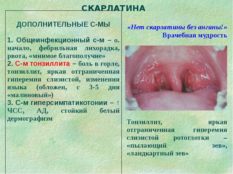 Дифференциальная диагностика сыпи презентация