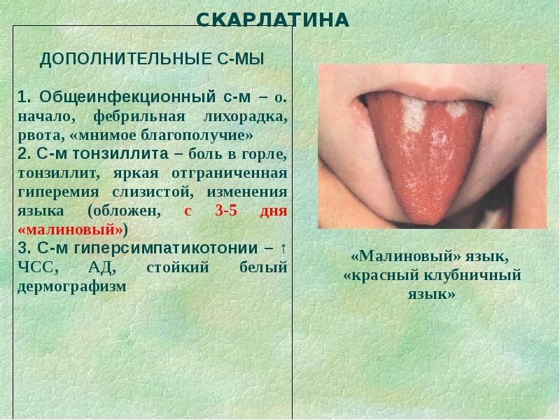 Дифференциальная диагностика сыпи презентация