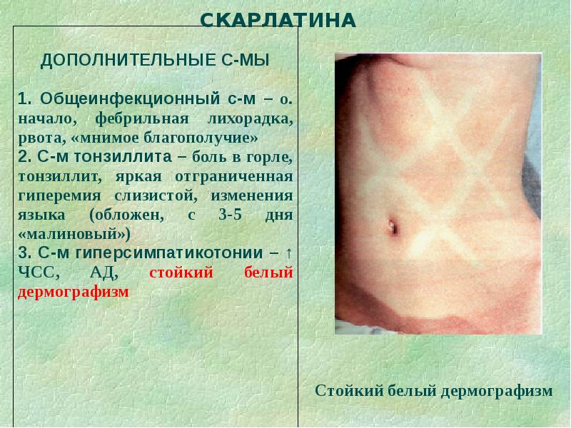 Дифференциальная диагностика сыпи презентация