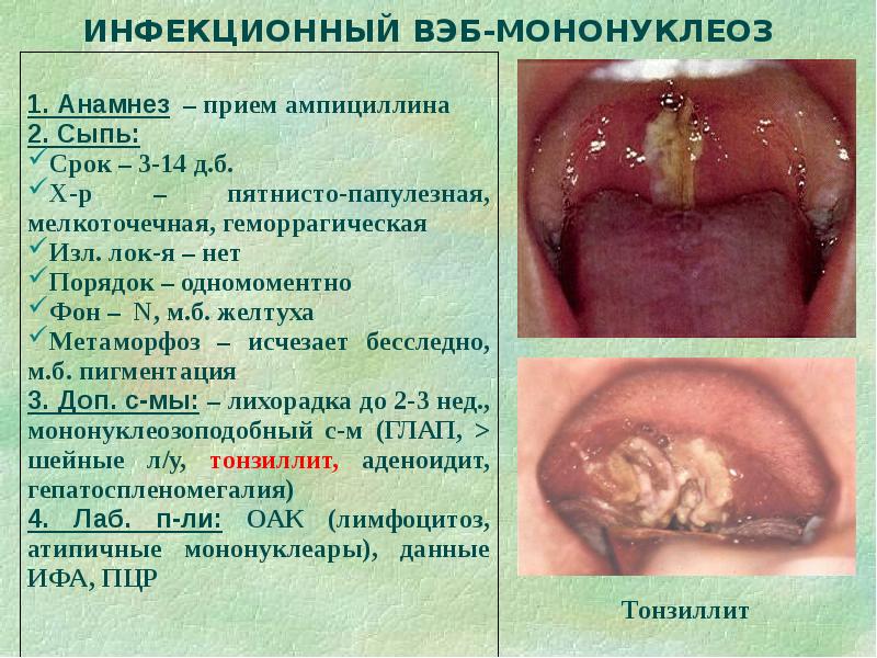 Дифференциальная диагностика сыпи презентация