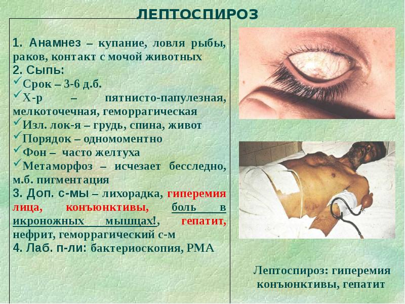 Дифференциальная диагностика сыпи презентация