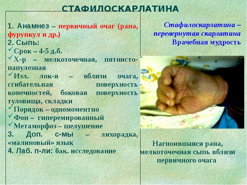 Дифференциальная диагностика сыпи презентация