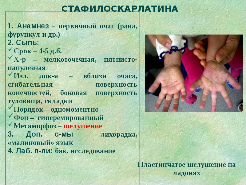 Дифференциальная диагностика сыпи презентация