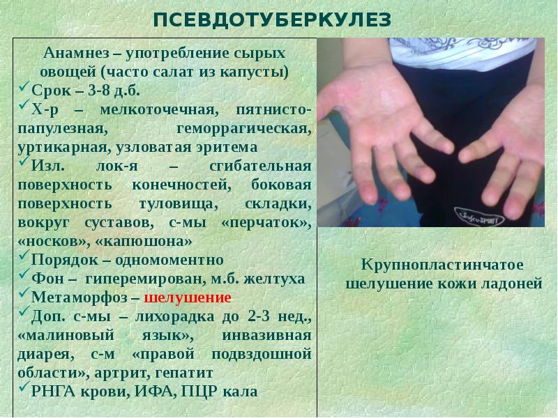 Дифференциальная диагностика сыпи презентация