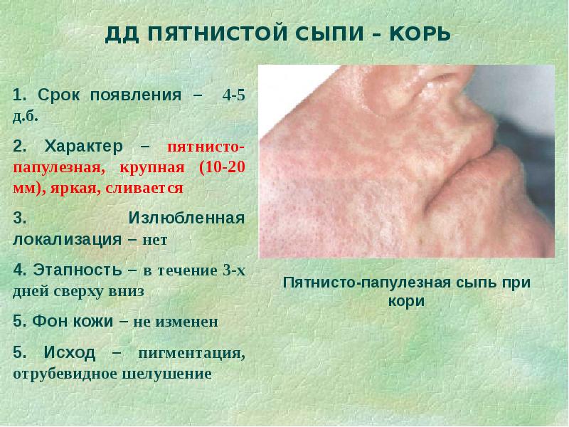 Дифференциальная диагностика сыпи презентация