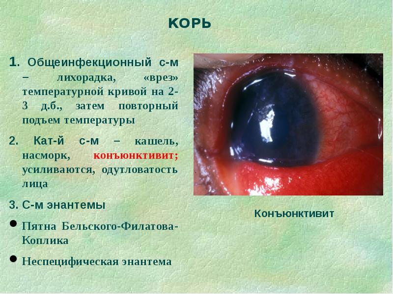 Дифференциальная диагностика сыпи презентация