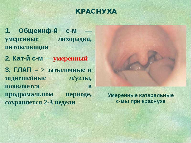 Дифференциальная диагностика сыпи презентация