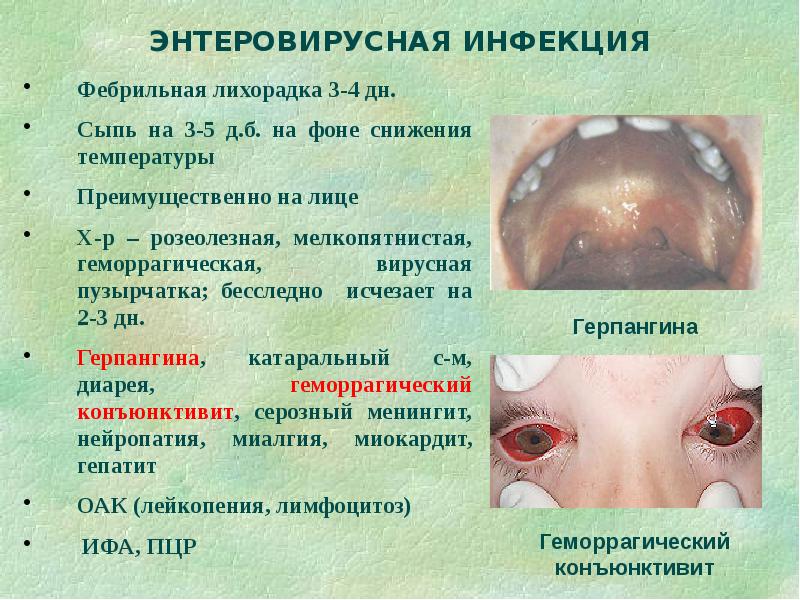 Дифференциальная диагностика сыпи презентация