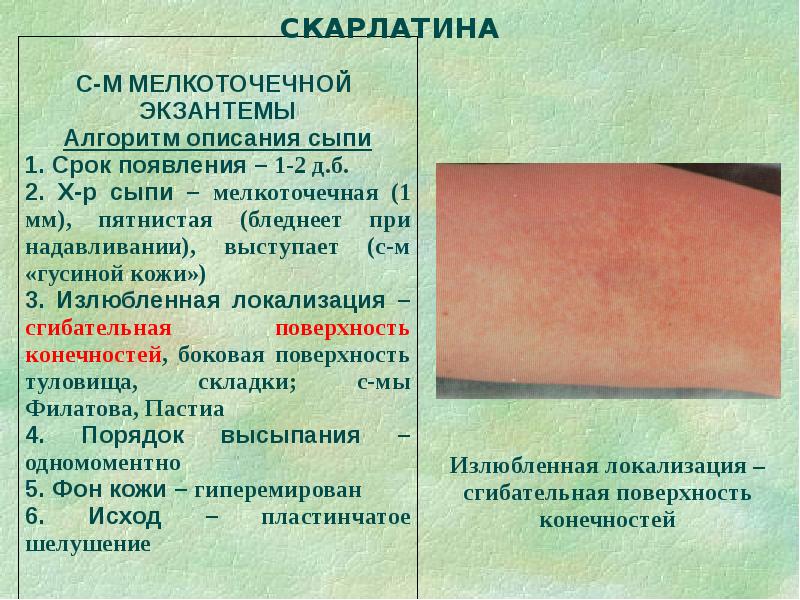 Дифференциальная диагностика сыпи презентация